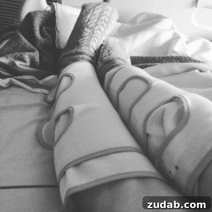 The Ember of Faith in Midnight's Grasp 2 A photo of legs wrapped in massage cuffs.