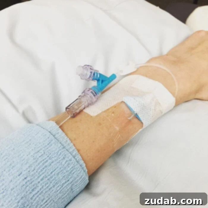 A photo of my arm with an IV in it.