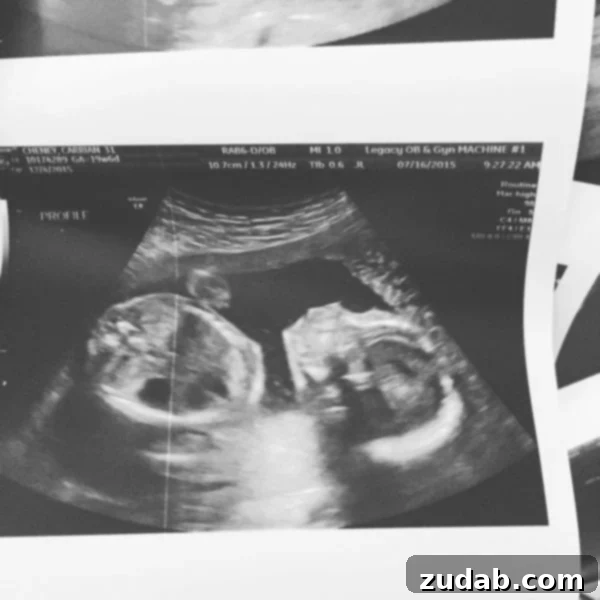 The 22nd Battle for Belief in the Shadows 3 A photo of an ultrasound of a baby, representing early concerns about growth and heart health.