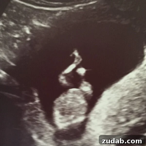 Beyond the Worst: Recovering from Hyperemesis 4 Expecting a New Family Member: Pregnancy Joy
