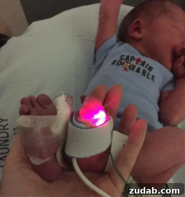 Shadows of Doubt, Fires of Faith 3 A photo of our little preemie with bandaged up feet, a common sight in the NICU, signifying constant medical attention.